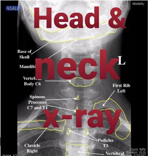For pain relief and healing physiotherapy and massage2