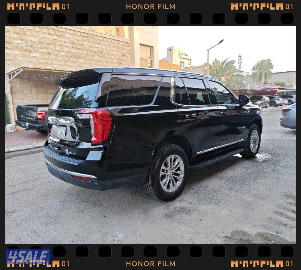 بحالة نادرة11