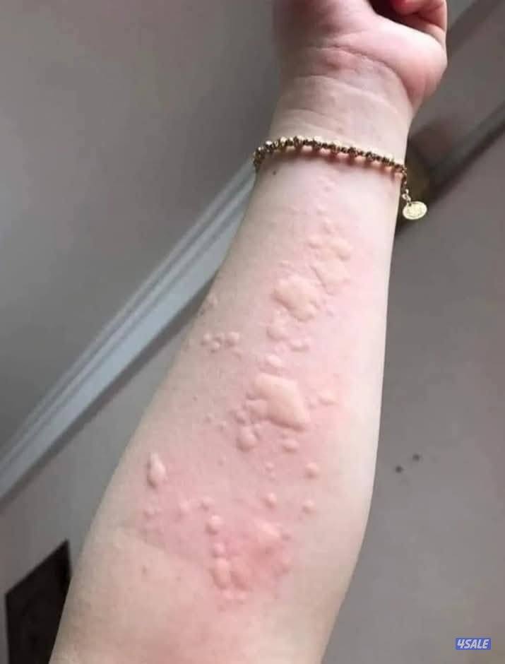 مكافحه الحشرات والقوارض4