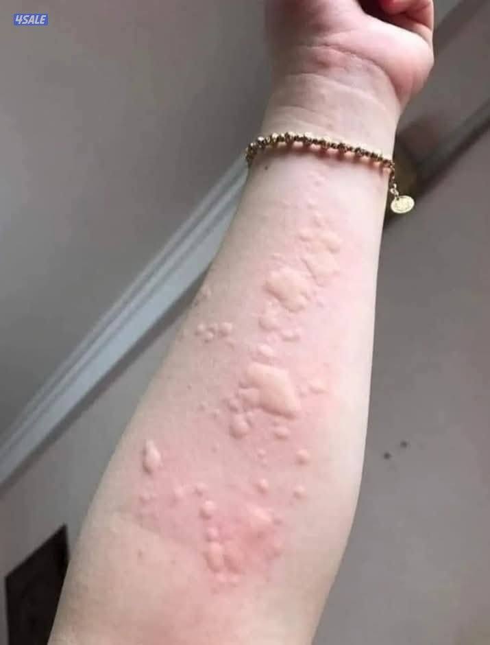 مكافحه الحشرات والقوارض6