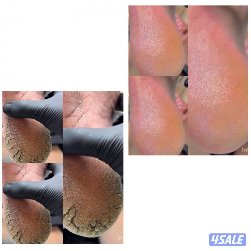 مساج علاجي او ريلاكس7دك 💆🏻‍♂️حمام مغربيVIP 7دك🧖🏻‍♂️مانيكير4دك💅🏻باديكير4دك ❤️🇰🇼❤️🇱🇧❤️9