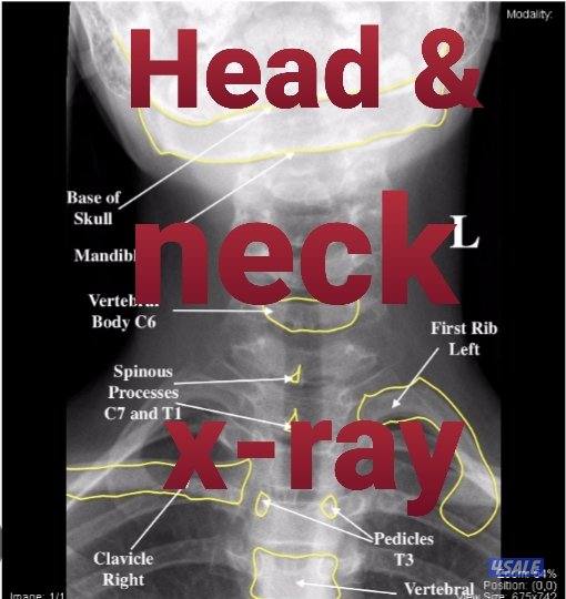 physiotherapy/medical massage/chiropractic treatment/spa2