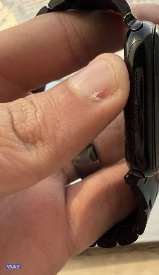 Apple Watch series 10 46m3