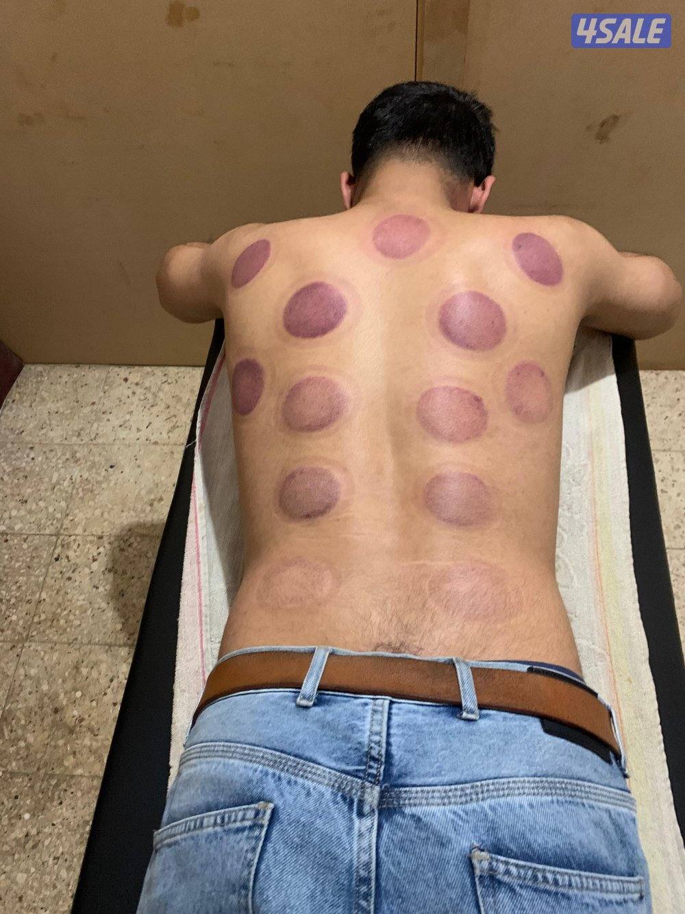 السالمية شارع عمان معهد سيرينو سبا امام مطعم الازرق1