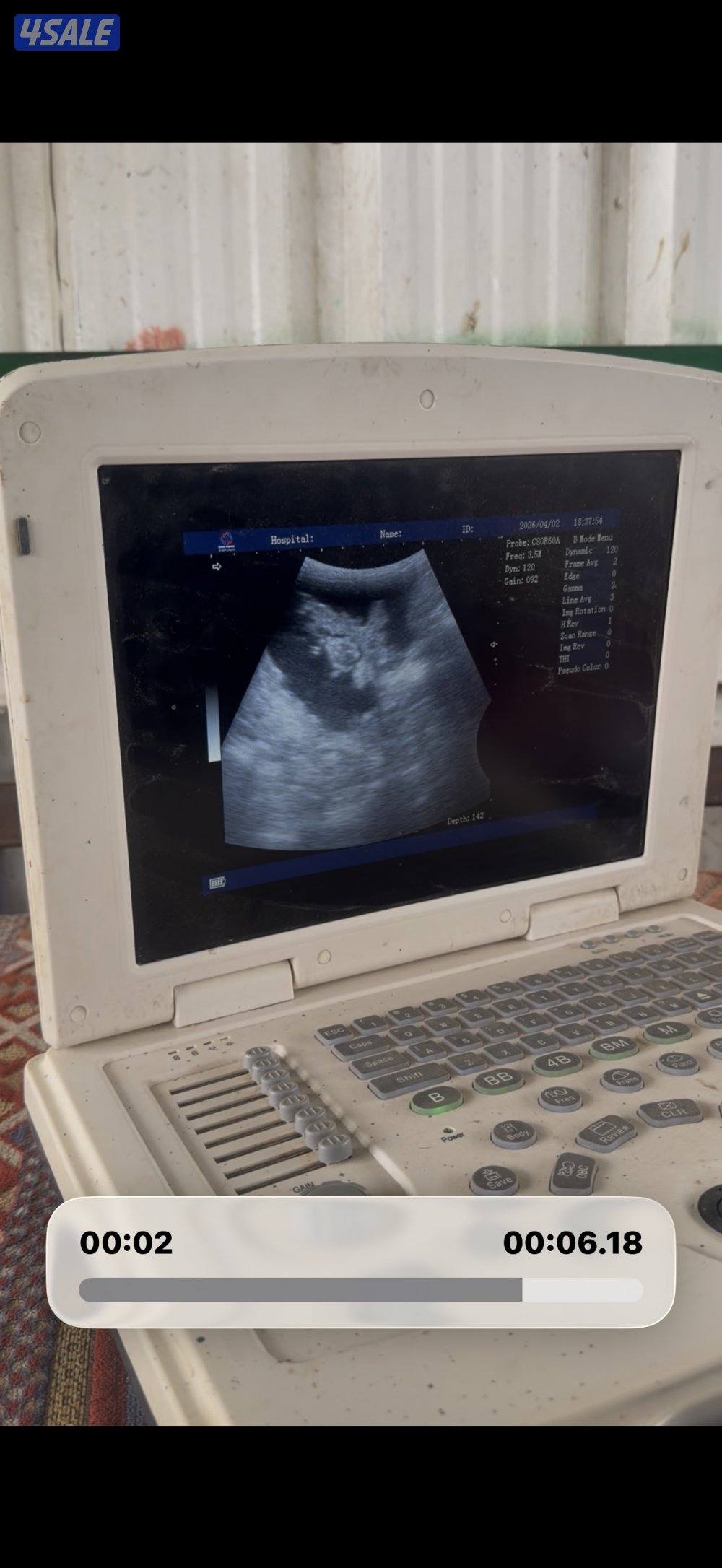 معزا ربش العداد 12 مع التيس فيها 6 مطافيل  تحتهم 7 دفيع فيها 4 متاويم0