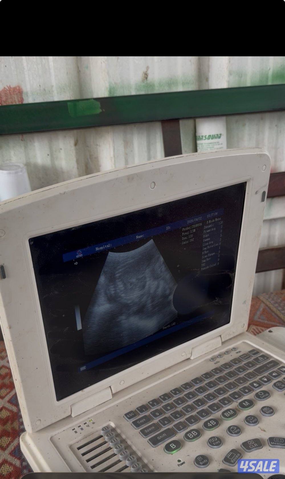 معزا ربش العداد 12 مع التيس فيها 6 مطافيل  تحتهم 7 دفيع فيها 4 متاويم8