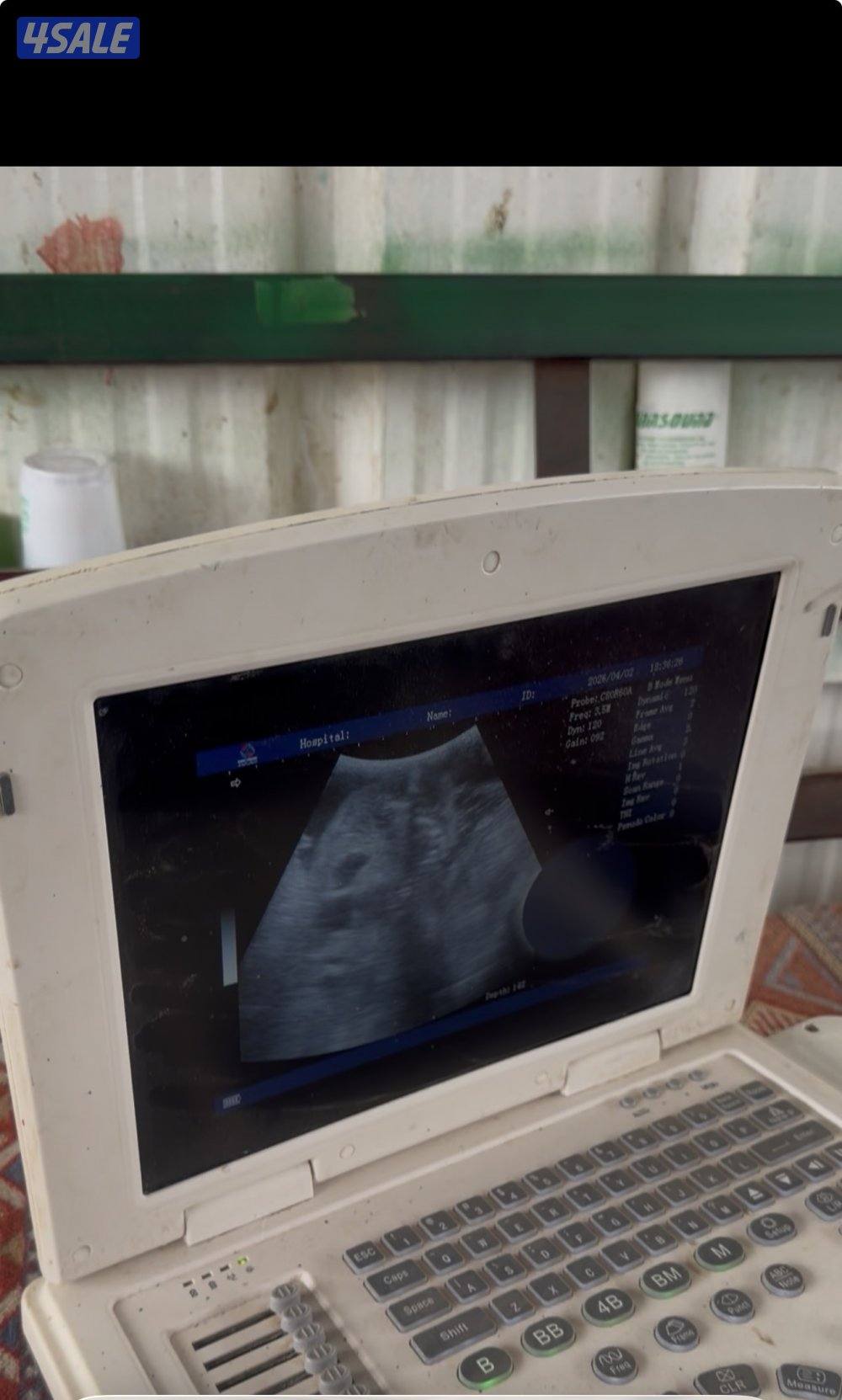 معزا ربش العداد 12 مع التيس فيها 6 مطافيل  تحتهم 7 دفيع فيها 4 متاويم9