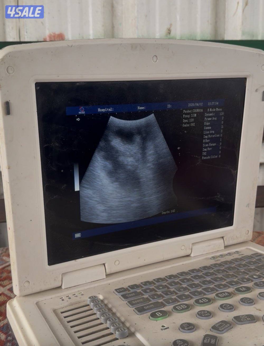 معزا ربش العداد 12 مع التيس فيها 6 مطافيل  تحتهم 7 دفيع فيها 4 متاويم10