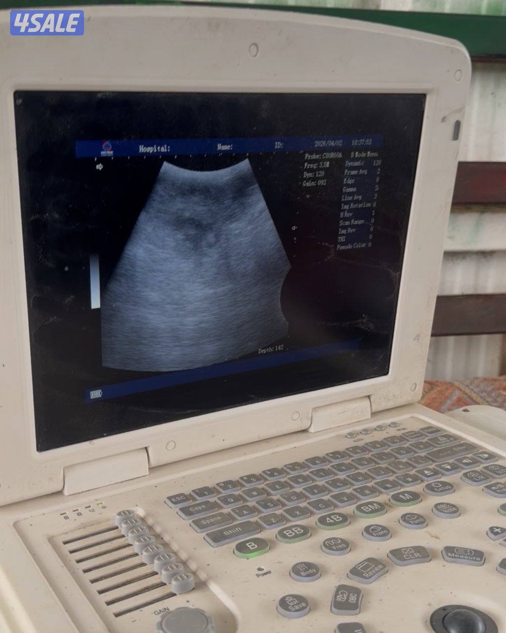 معزا ربش العداد 12 مع التيس فيها 6 مطافيل  تحتهم 7 دفيع فيها 4 متاويم11