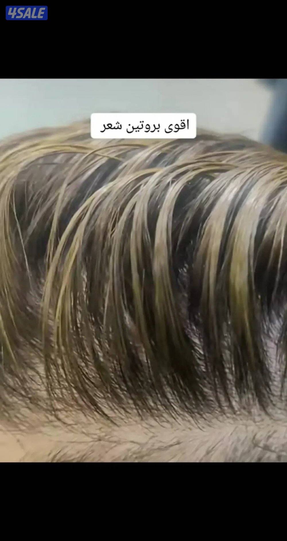 ✨ خبرة 25 سنة في إدارة السبا والخدمات الطبية والتجميلية الآن في الكوي4