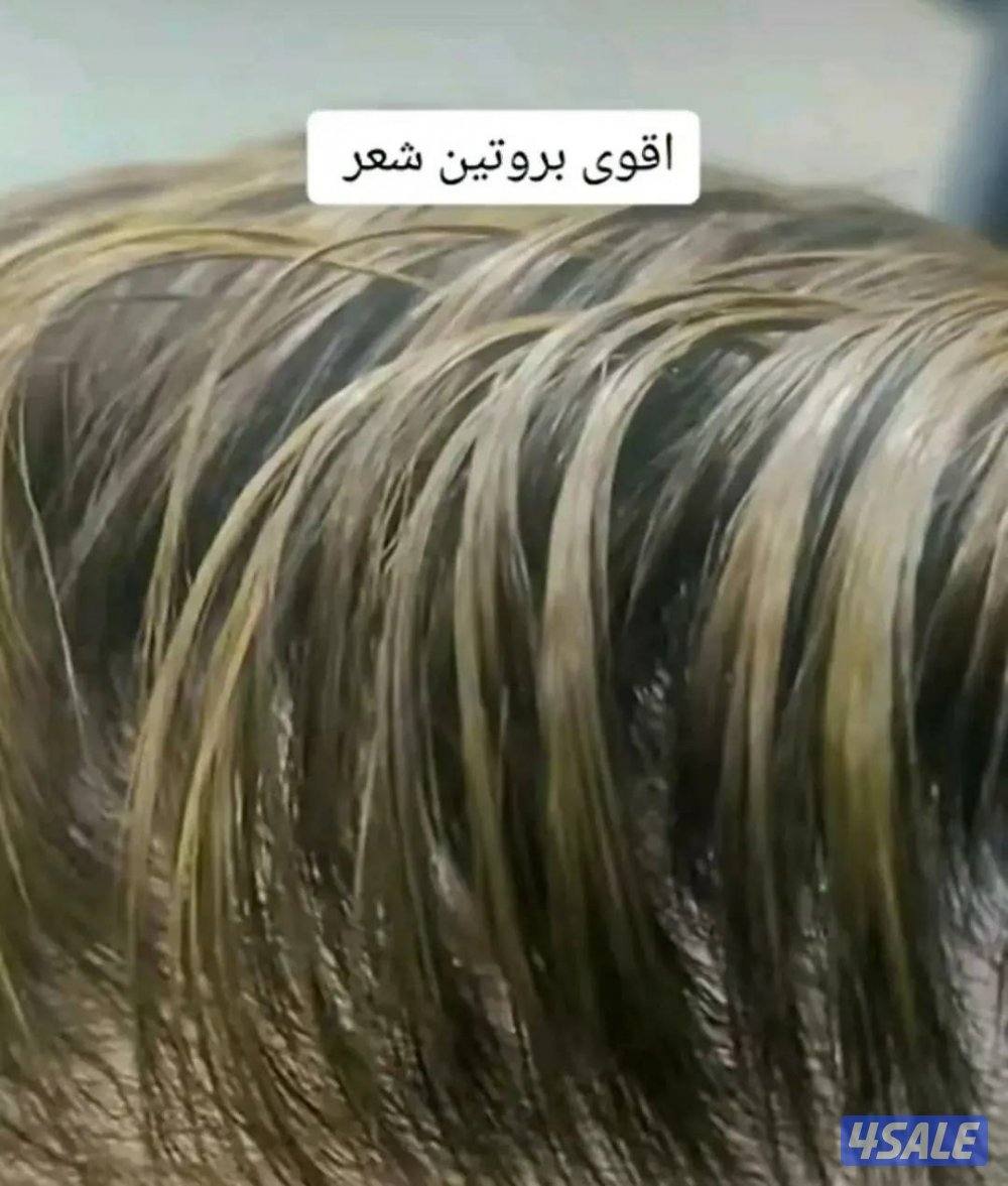 ✨ خبرة 25 سنة في إدارة السبا والخدمات الطبية والتجميلية الآن في الكوي6